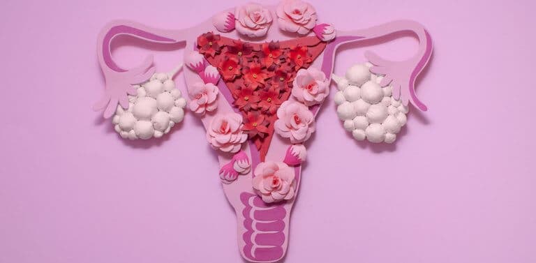 PCOS en leefstijl